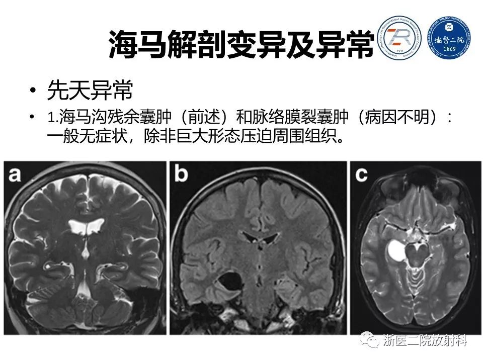 准确解剖