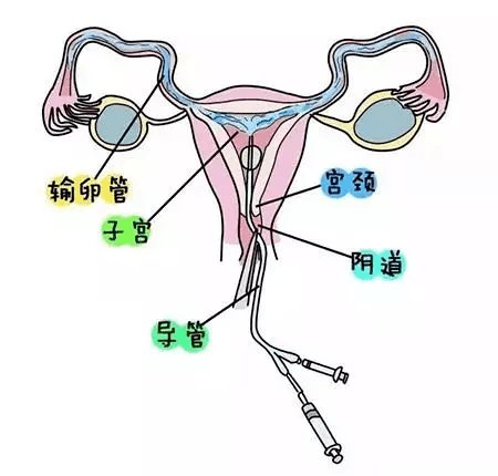 通草的功效与作用能通输卵管堵塞_最新热门含义落实_精简版211.40.248.11