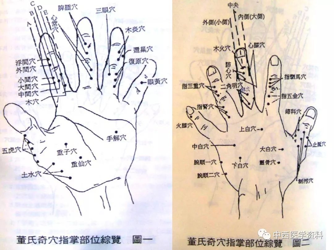 董氏奇穴探索，中医奥秘宝库下载指南