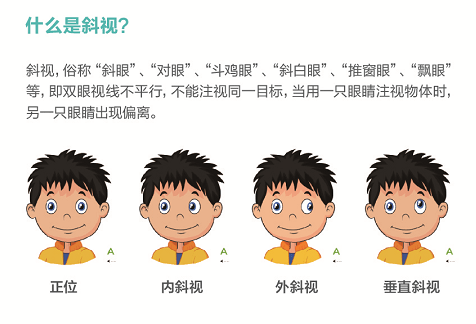 驾照新政，斜视者的福音时代来临